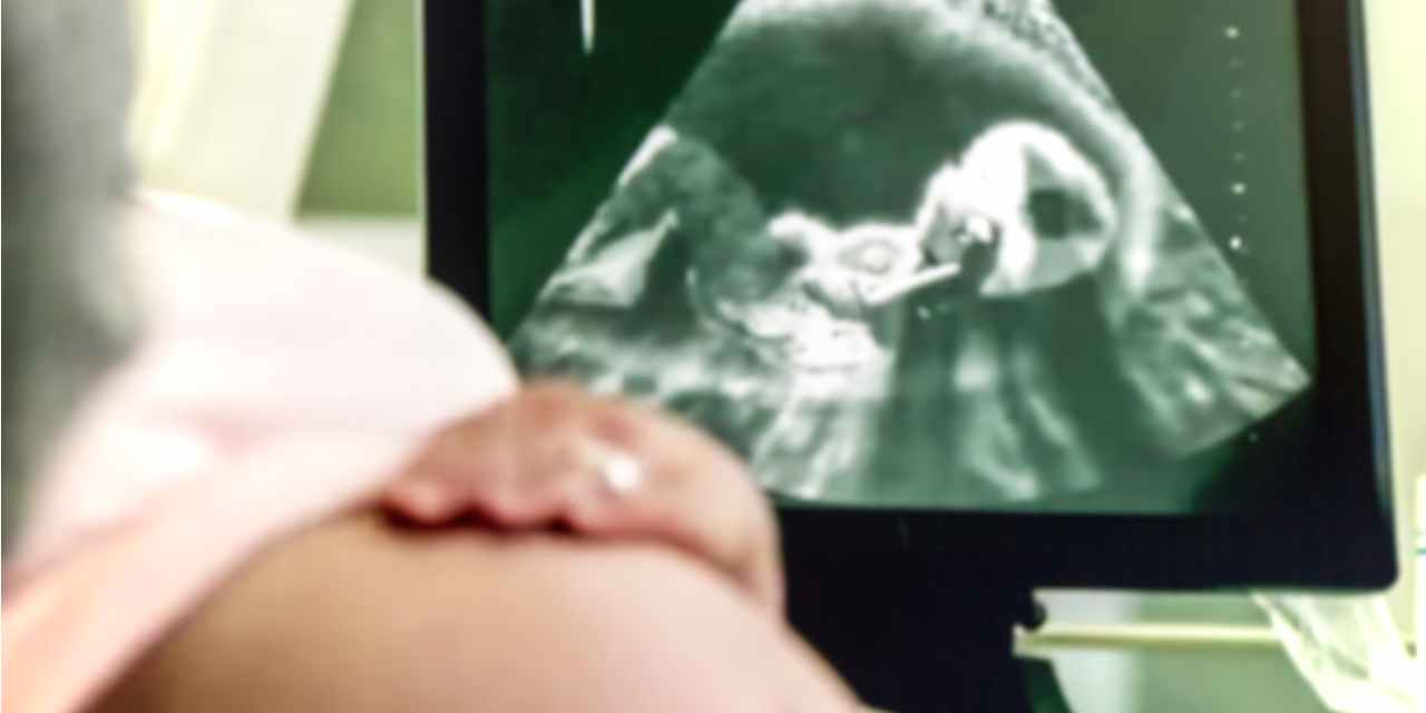 Fetus ultrasound, pregnant woman
